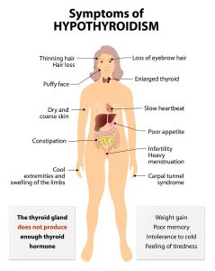 natural remedies of hypothyroidism in women