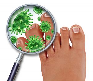 natural remedies for toe nail fungus