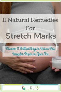 natural remedies for stretch marks