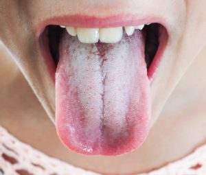 the benefits of tongue scraping