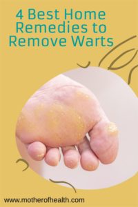 best home remedies to remove warts