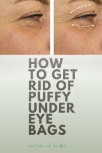 how to get rid of puffy under eye bags
