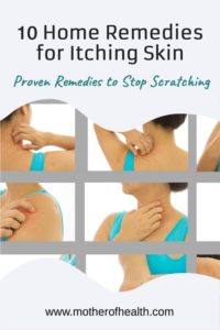 home remedies for itching skin