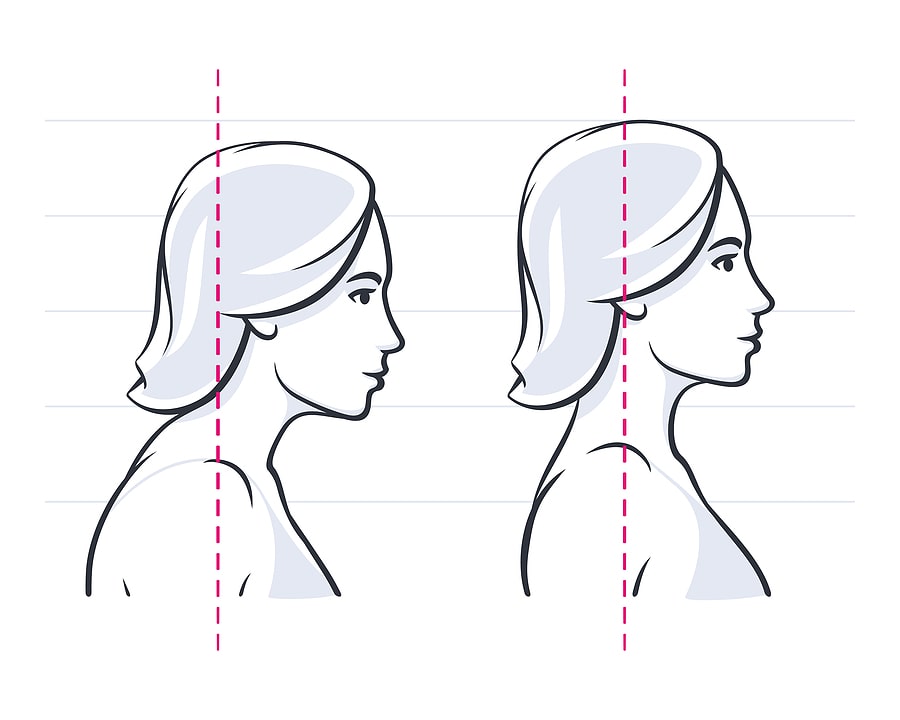 woman with poor posture (image)
