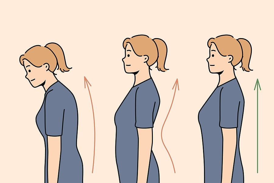 woman standing with and without poor posture (image)